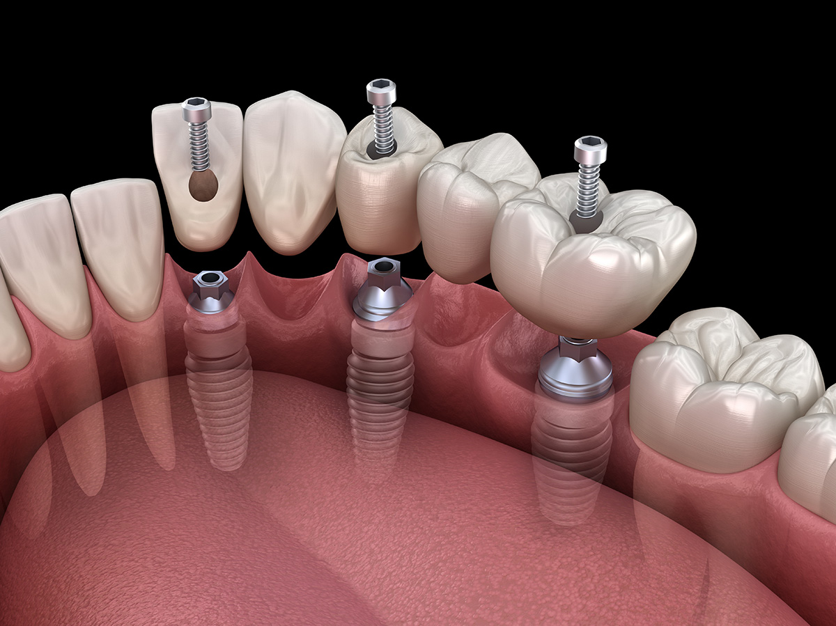 European Dental Lab