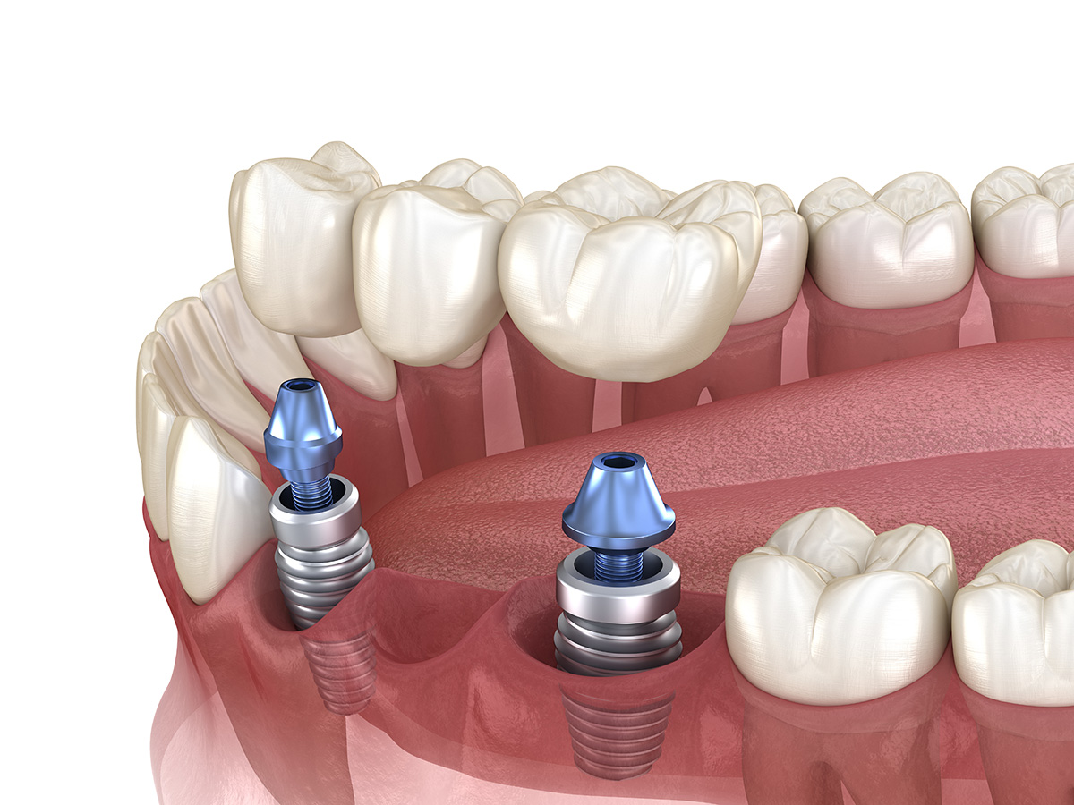European Dental Lab