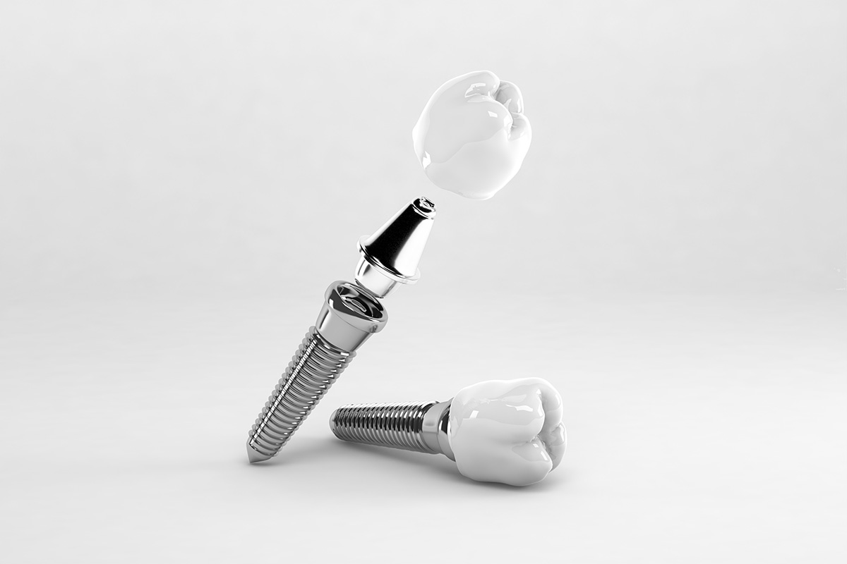 European Dental Lab