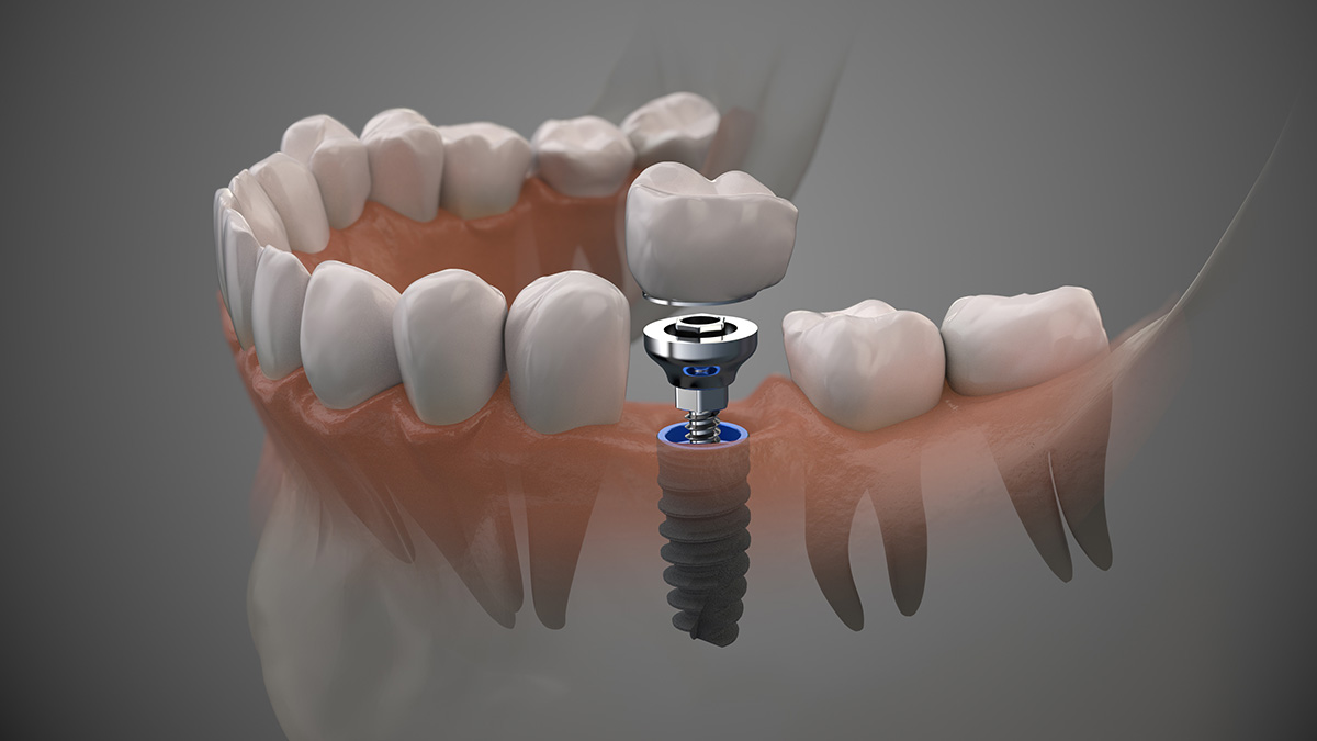 European Dental Lab