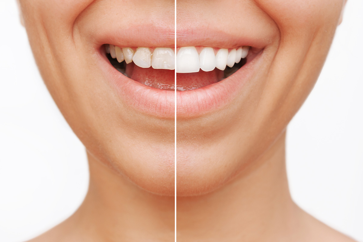 European Dental Lab