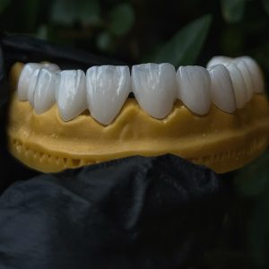 520942650 18068966360036256 4398626010667643556 N 300X300
