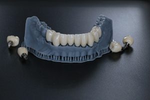 561529054 18076777412036256 6587706260233297788 N 300X200
