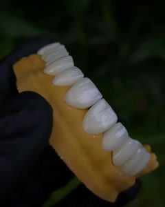 590841454 18082341977036256 177886131361962170 N 240X300
