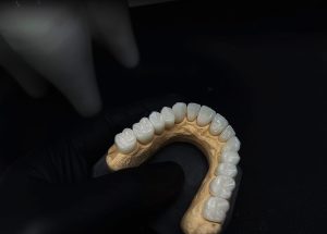 641430101 18091021271036256 5470123720231369375 N 300X215